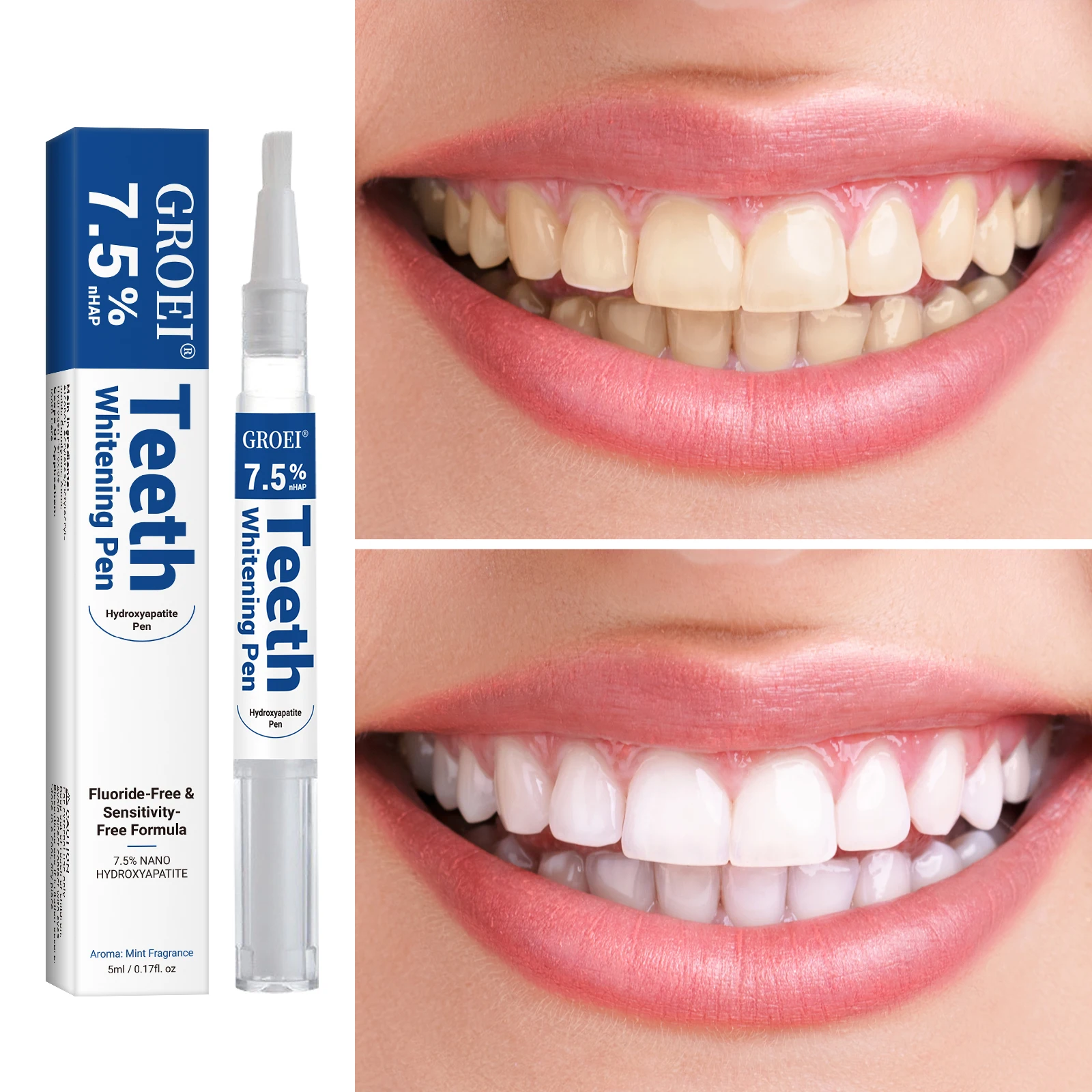 Hydroxyapatite Tooth Whitening - Teeth Whitening With Peroxide ulasan dan harga