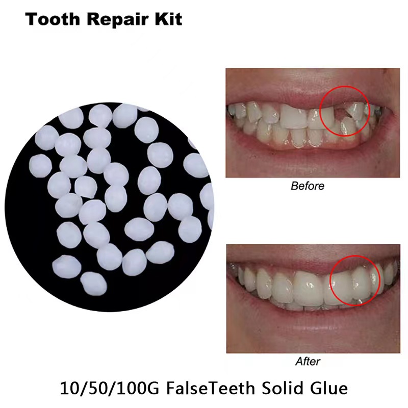 10g/bag Tooth Repair Kit-therm - Teeth Whitening Mask ulasan dan harga