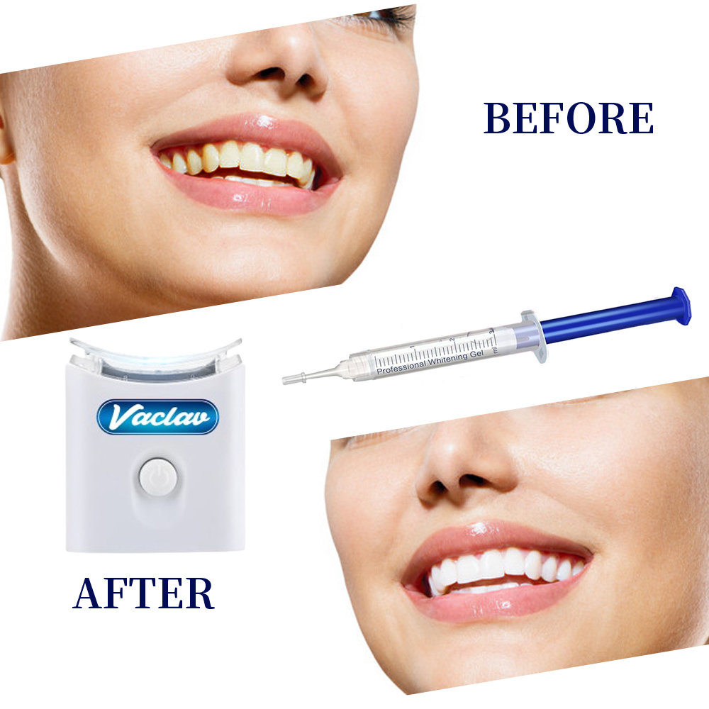 Mint Teeth Whitening Gel Syrin - Teeth Whitening Gel Syringes ulasan dan harga