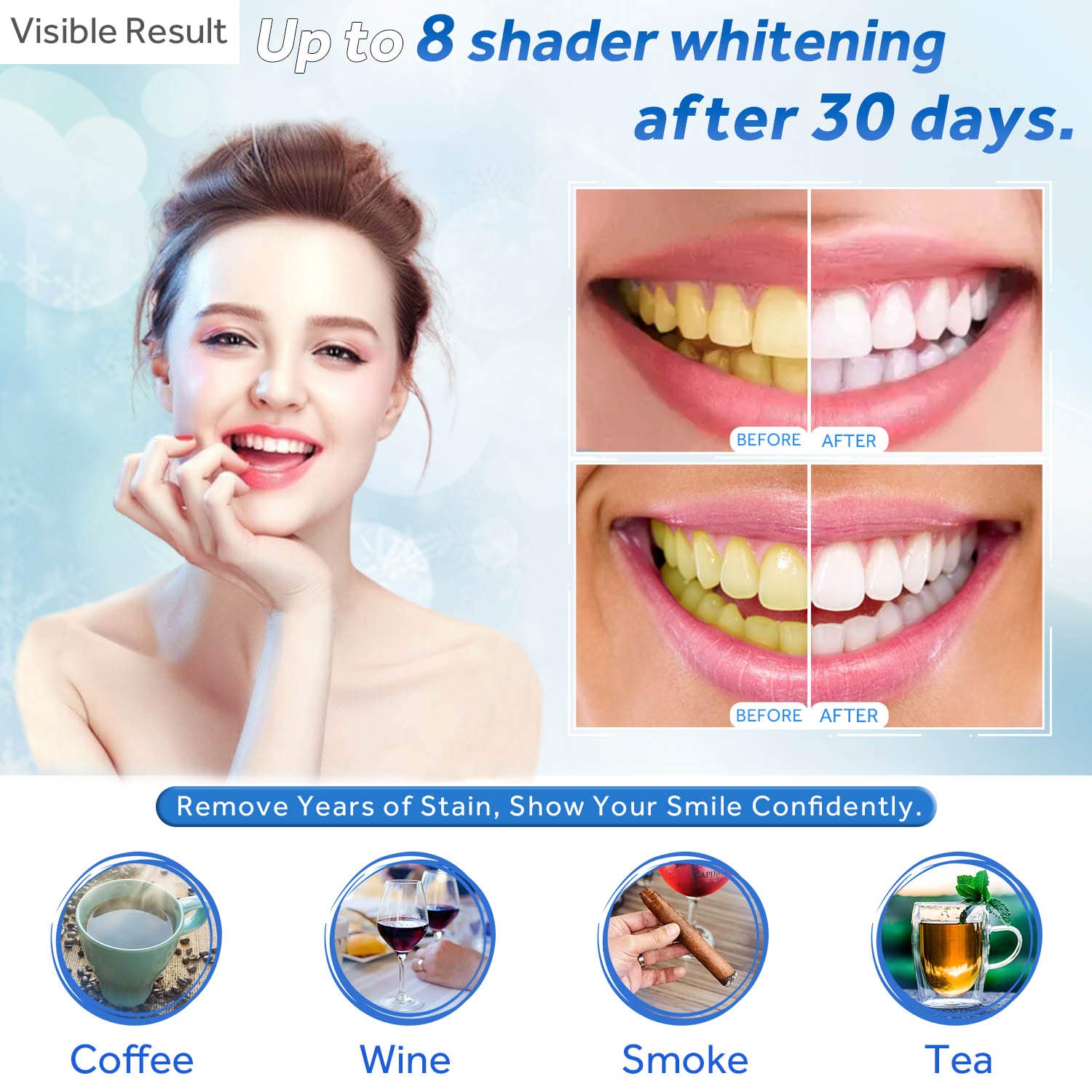 Teeth Whitening Gel Refill Syr - Teeth Whitening Gel Syringes ulasan dan harga