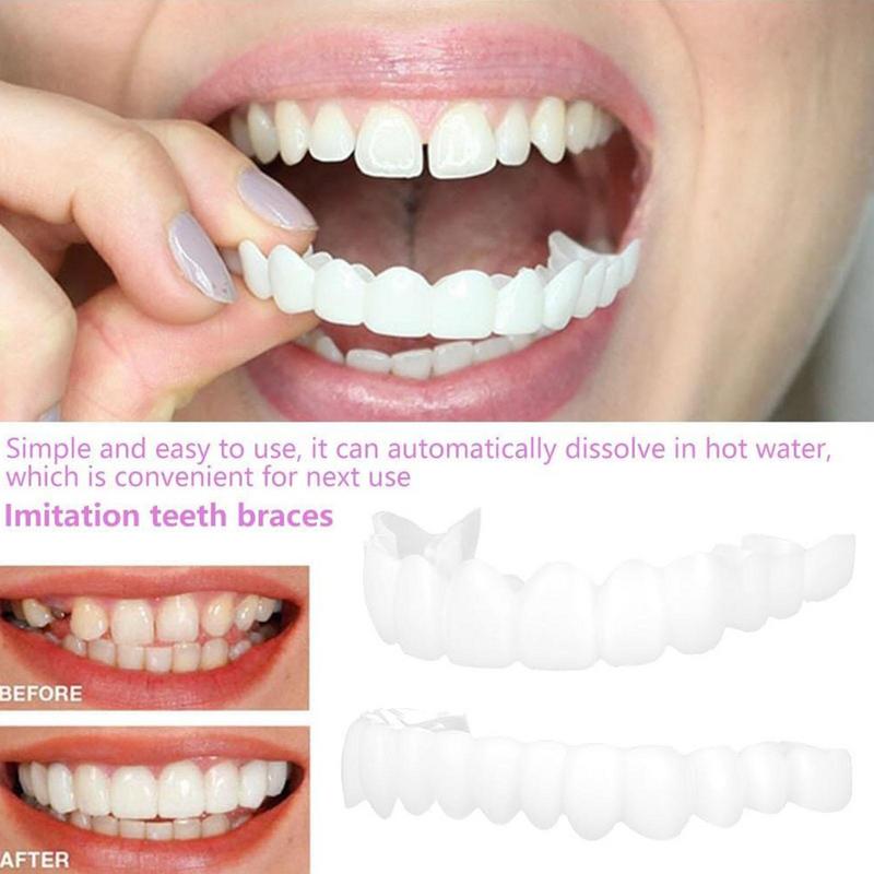Snap On Teeth Veneers Instant  - Teeth Whitening Mask ulasan dan harga