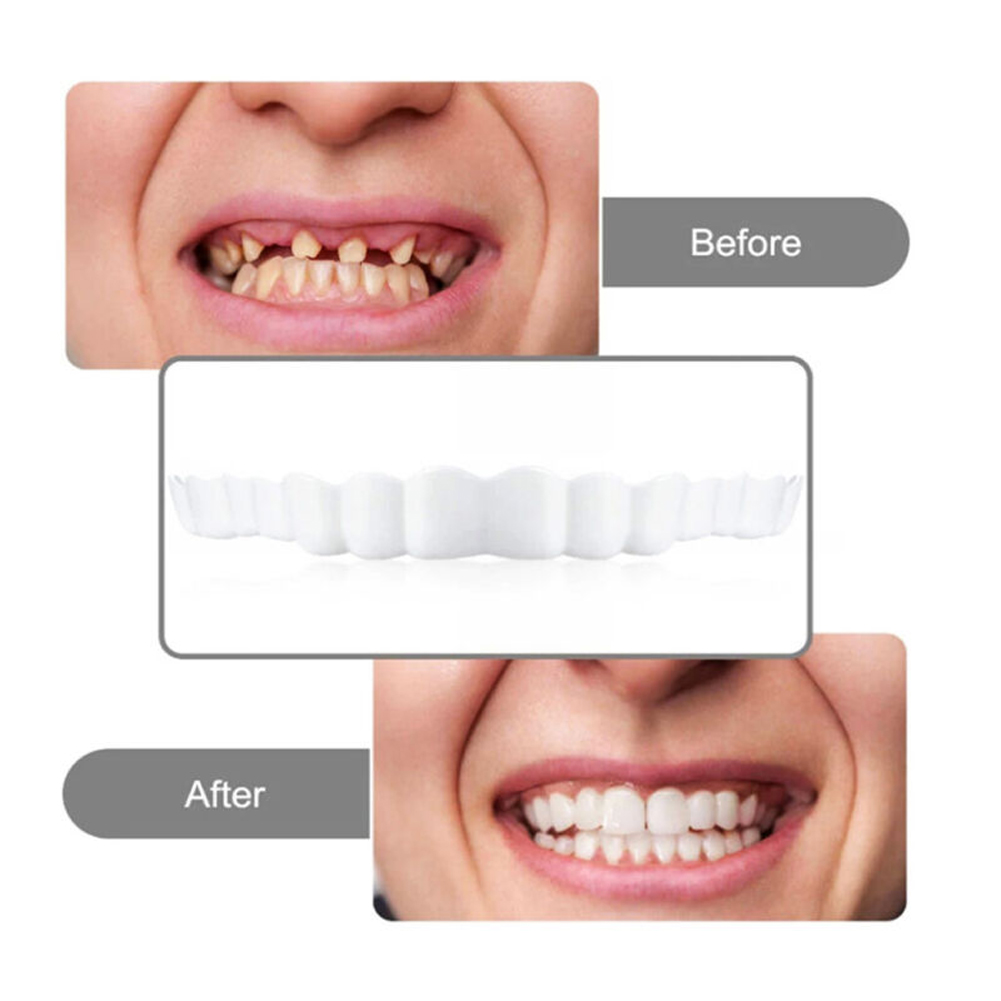 4-6 Pairs Upper&Lower Jaw Dent - Teeth Whitening Mask ulasan dan harga