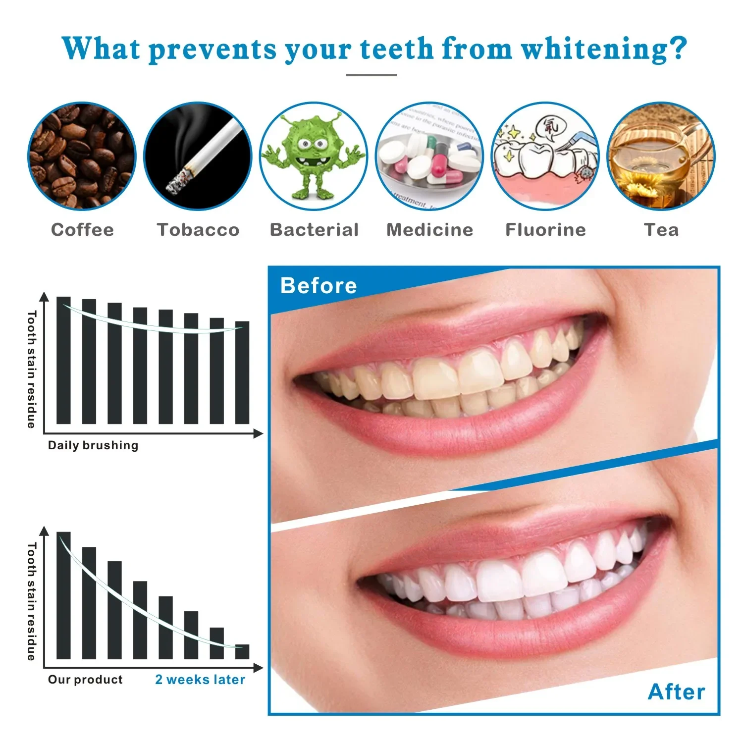 14/28pcs 3D Teeth Whitening St - Whitening Strip 3D ulasan dan harga