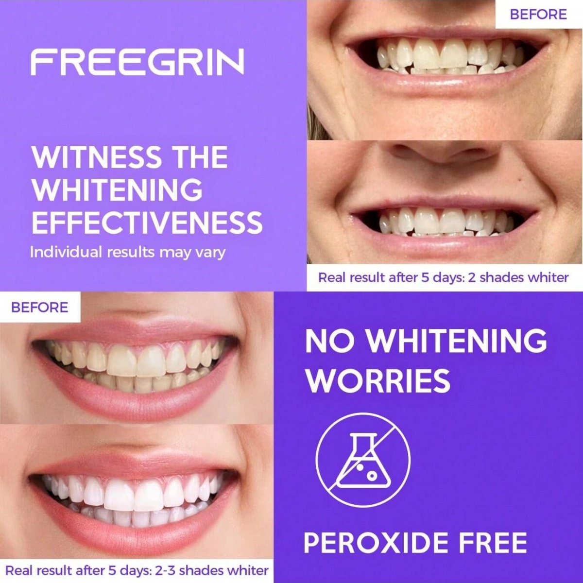 Deluxe Whitening Teeth Sticker - Teeth Whitening With Peroxide ulasan dan harga