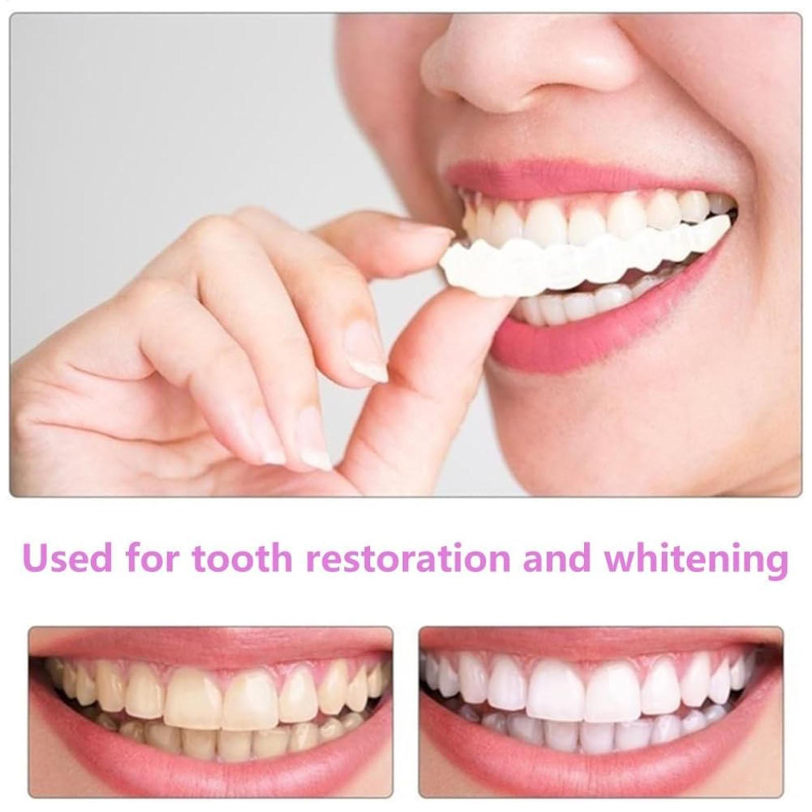 2pcs Men Women Temporary Teeth - Teeth Whitening Mask ulasan dan harga